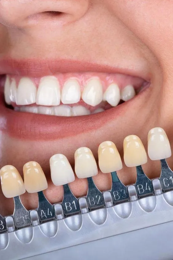 which is better zirconia or porcelain crown? which is better zirconia or porcelain crown?
